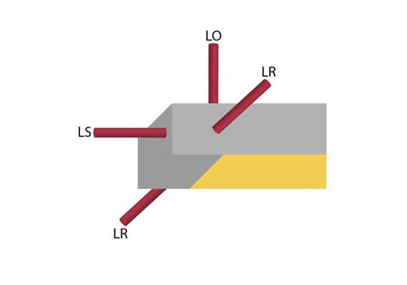 Position der Einspeisung beim Profil LL/ links - links  Bohrung links beim Profil