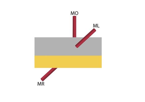 Position der Einspeisung beim Profil MR / mitte - rechts  Bohrung rechts beim Profil